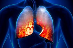 relx电子烟对肺有什么影响呢？缩略图
