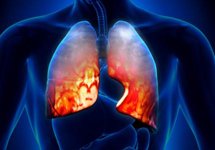 relx电子烟对肺的影响