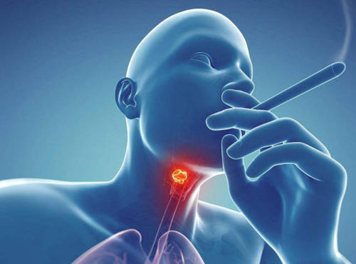 抽电子烟致癌概率大吗？