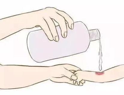 电子烟影响伤口吗？