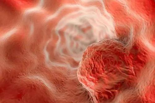 电子烟会导致食道癌吗？