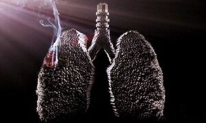 肺癌能抽电子烟吗？缩略图