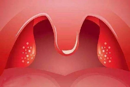 扁桃手术后可以抽电子烟吗？