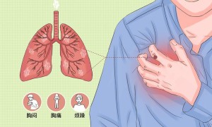 抽电子烟把肺抽爆了？（抽电子烟肺会爆炸吗）