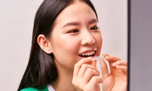 带牙齿保持器能抽电子烟吗